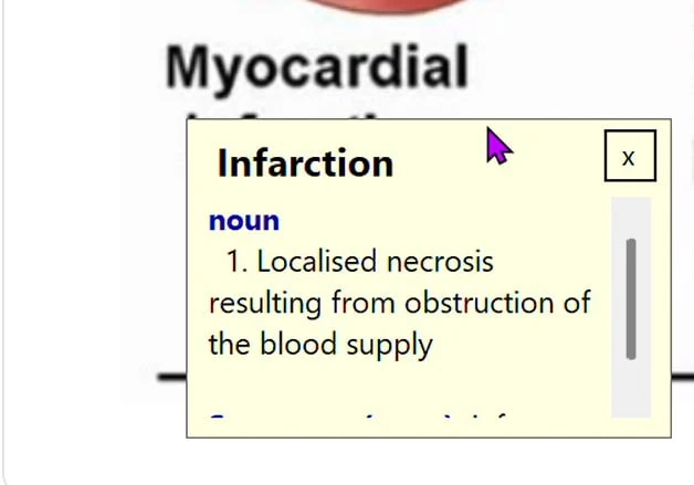 After clicking the dictionary icon on the Ctrl+Shift popup, the full offline-dictionary definition of 'Infarction' appears: noun — Localised necrosis resulting from obstruction of the blood supply.
